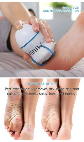 Find Back Electric Foot Vacuum Callus Remover